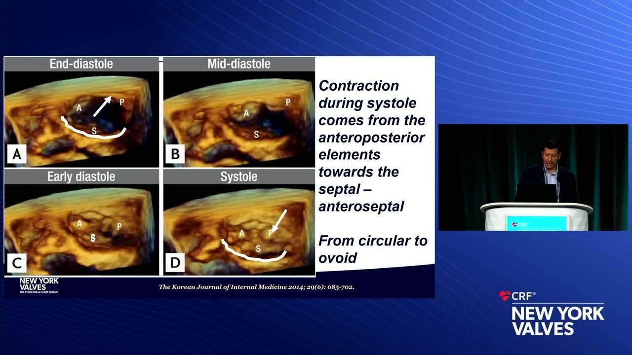 Anatomy for Tricuspid Interventions