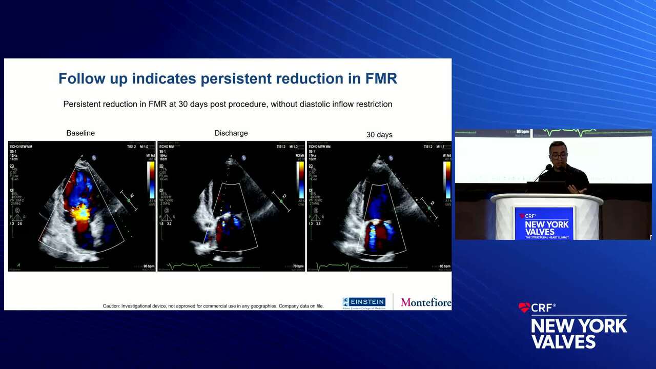 Other Transcatheter Therapies (Beyond TEER) for Functional MR