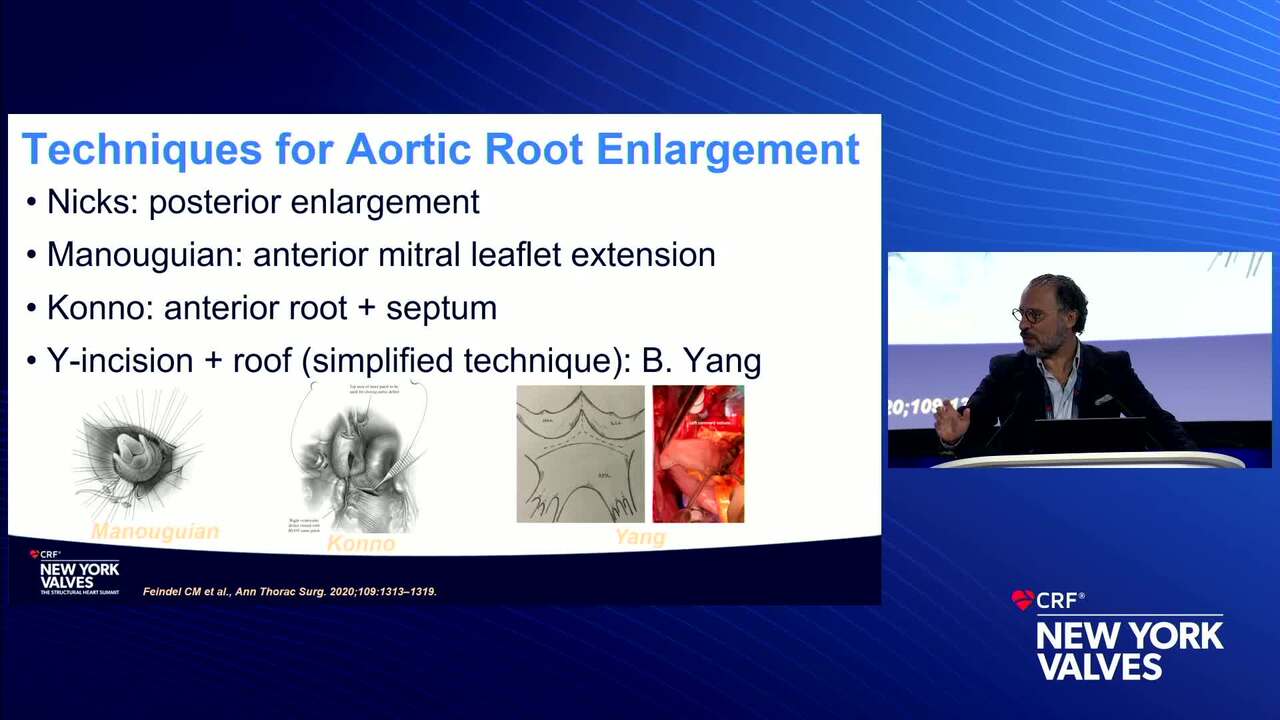 The “Reality” of Surgical Aortic Root Enlargement