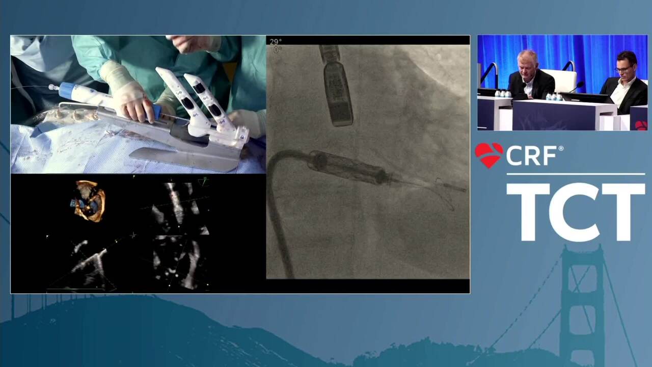 University Hospital of Cologne, Department of Cardiology, Cologne, Germany - A Novel Transcatheter Tricuspid Valve Replacement for TR