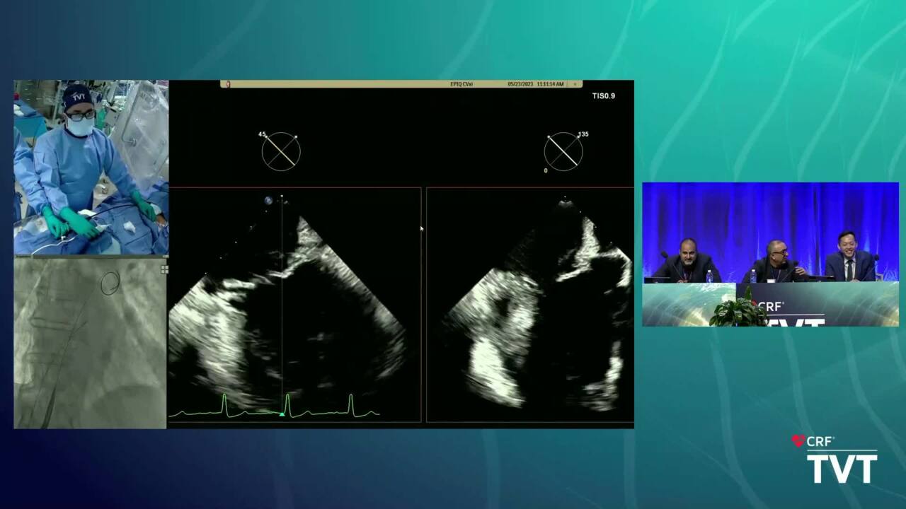 Live Case 28: ICE-Only Mitral TEER with PASCAL -Montefiore Medical Center - Bronx, NY
