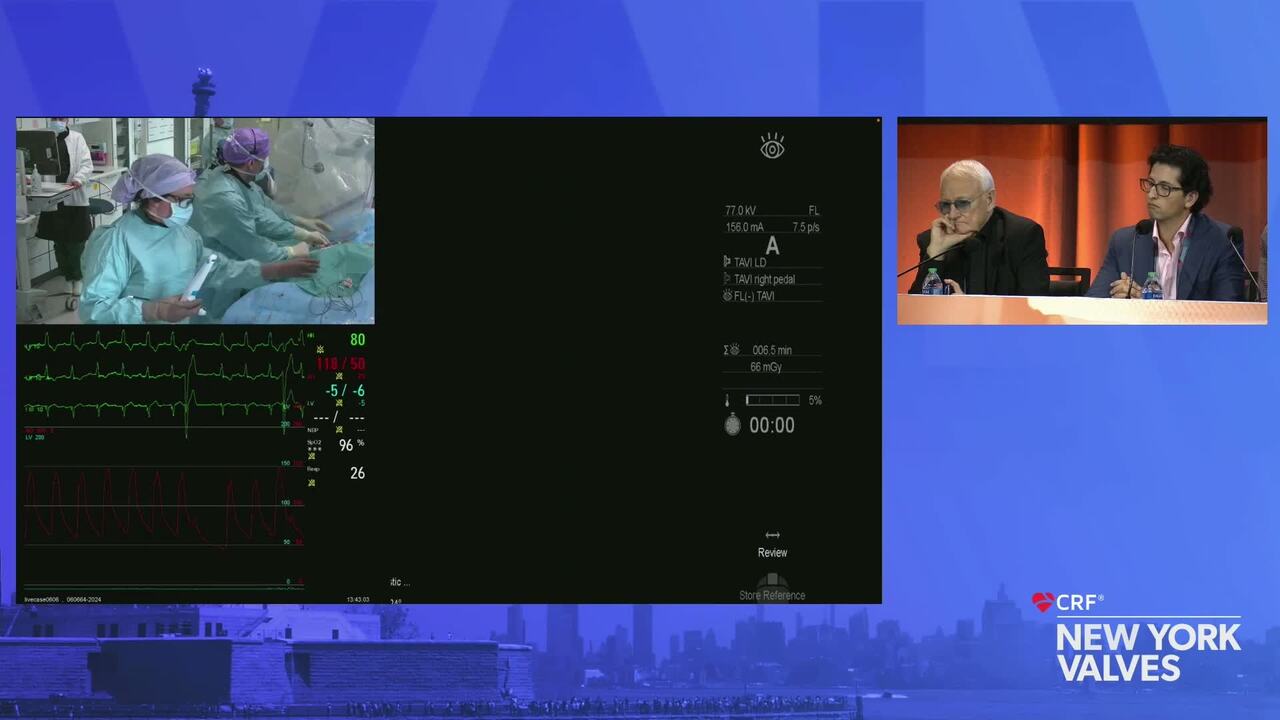 LIVE Case: New TAVR  -The Heart Center, Rigshospitalet, Copenhagen University Hospital, Copenhagen, Denmark
