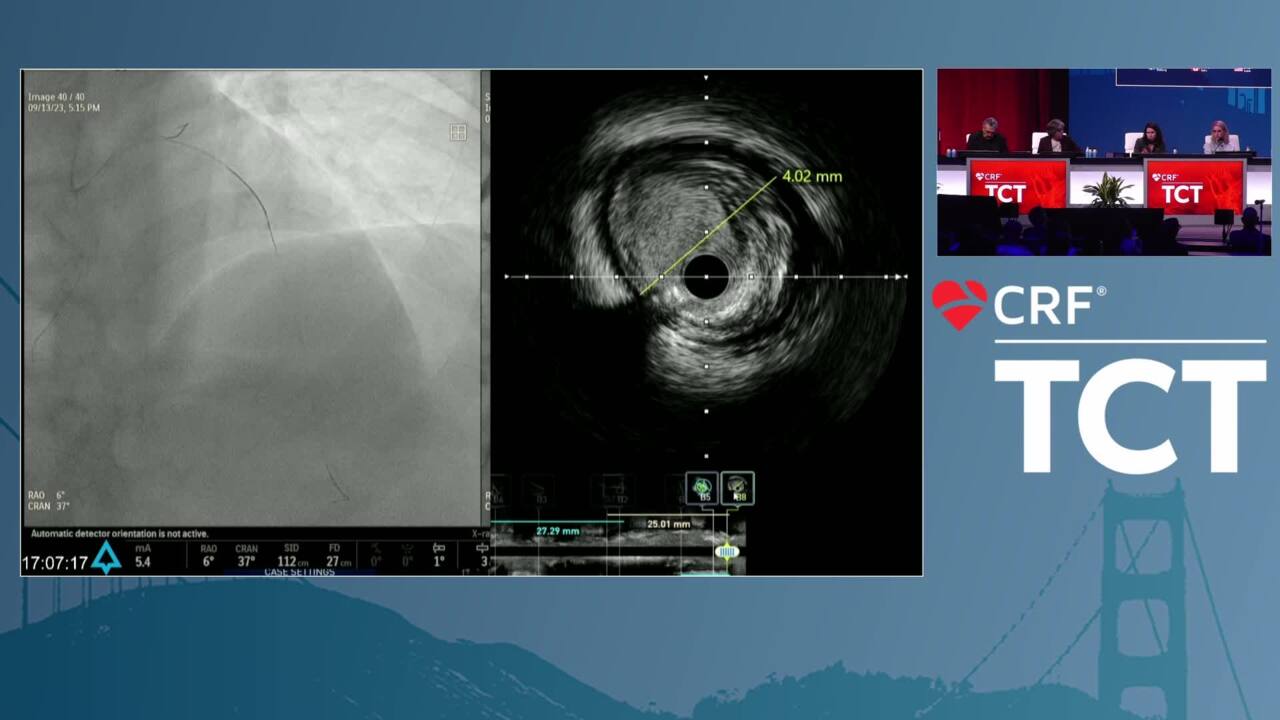 Live Case New York Presbyterian Hospital, Columbia University Medical Center, New York, NY - Complex Coronary PCI (CTO + MVD) and Ischemic Cardiomyopathy