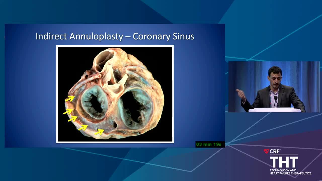 Atrial And Ventricular Functional Mr Treatment Implications