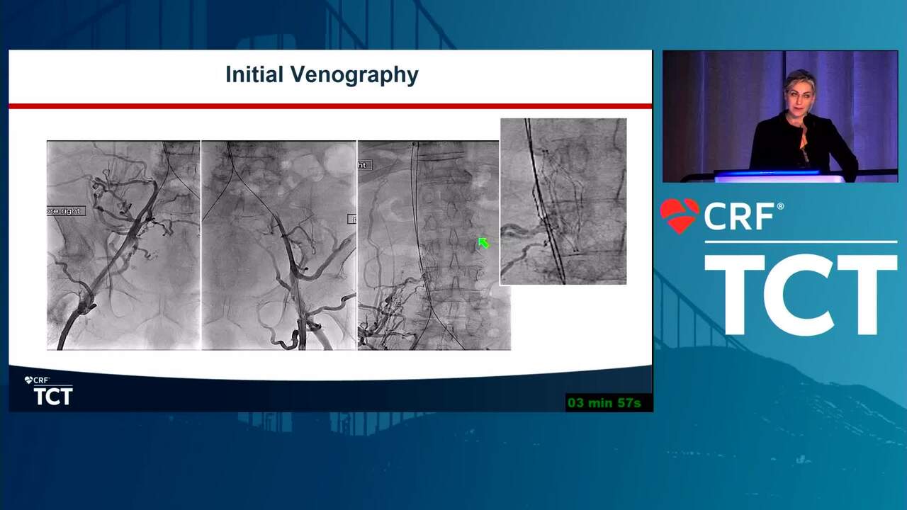 Iliocaval Reconstruction: From Preplanning to Execution