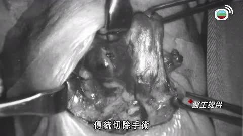 第201集