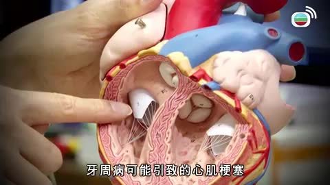 第195集