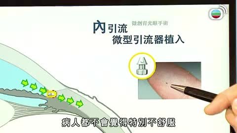 第191集