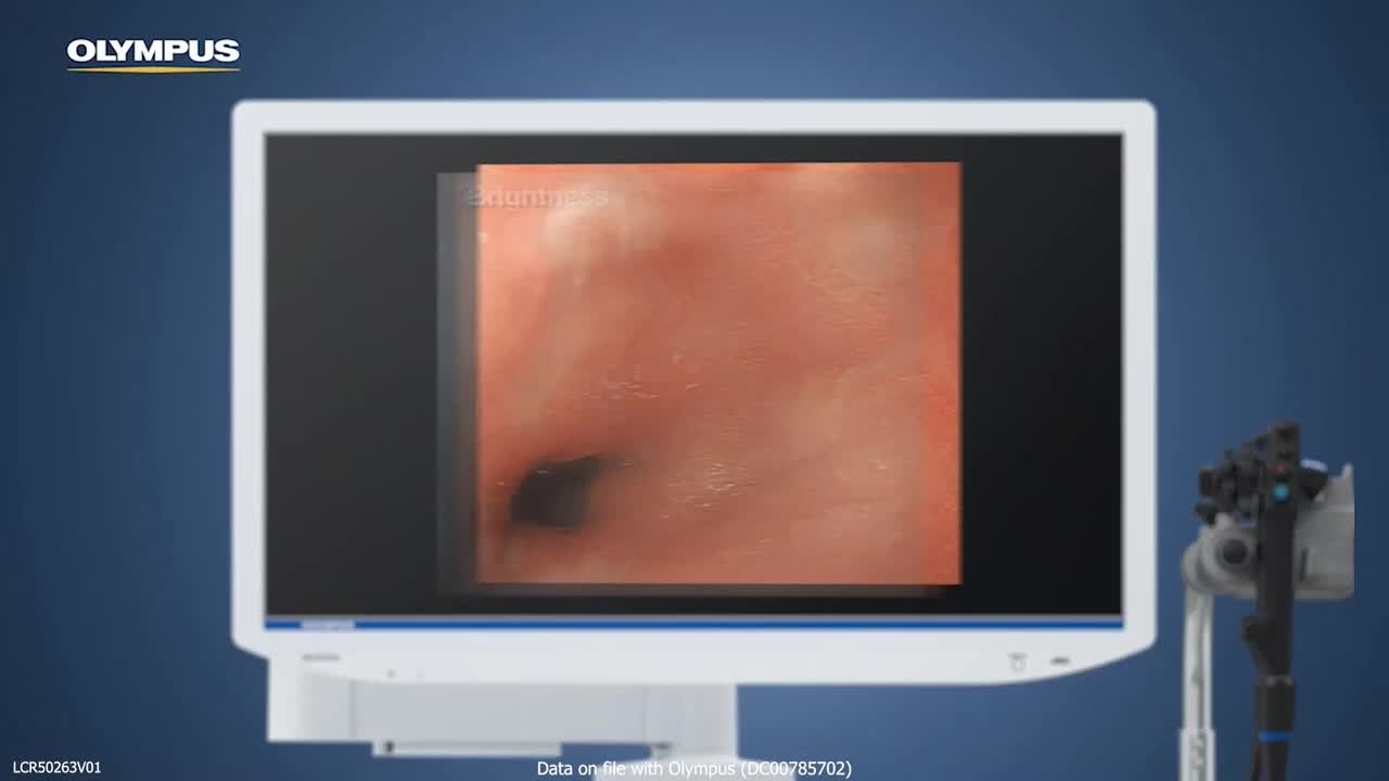 TXI™ Technology - Olympus Professional Education On-Demand Library