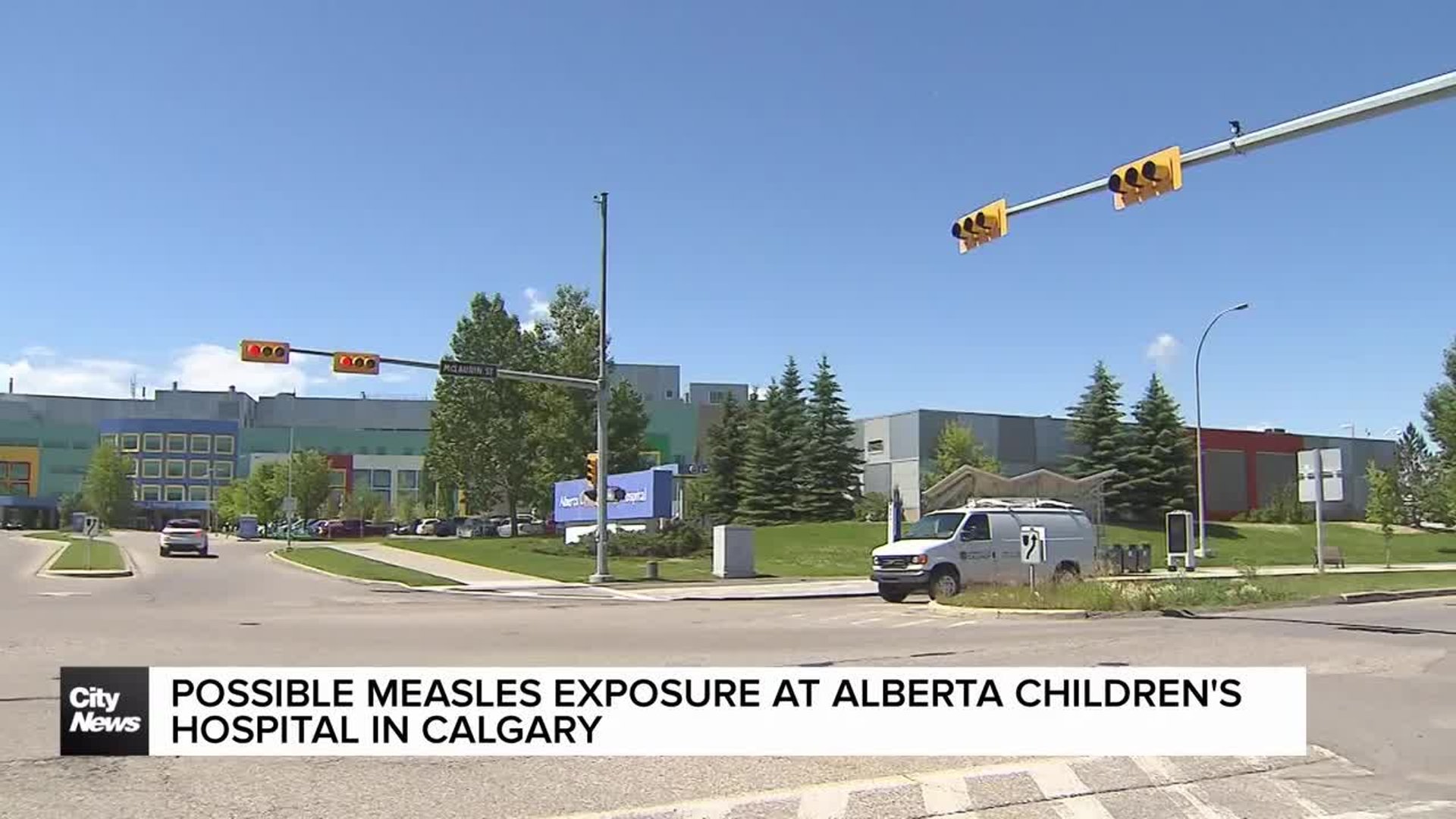 Possible measles exposure at Alberta Children’s Hospital in Calgary