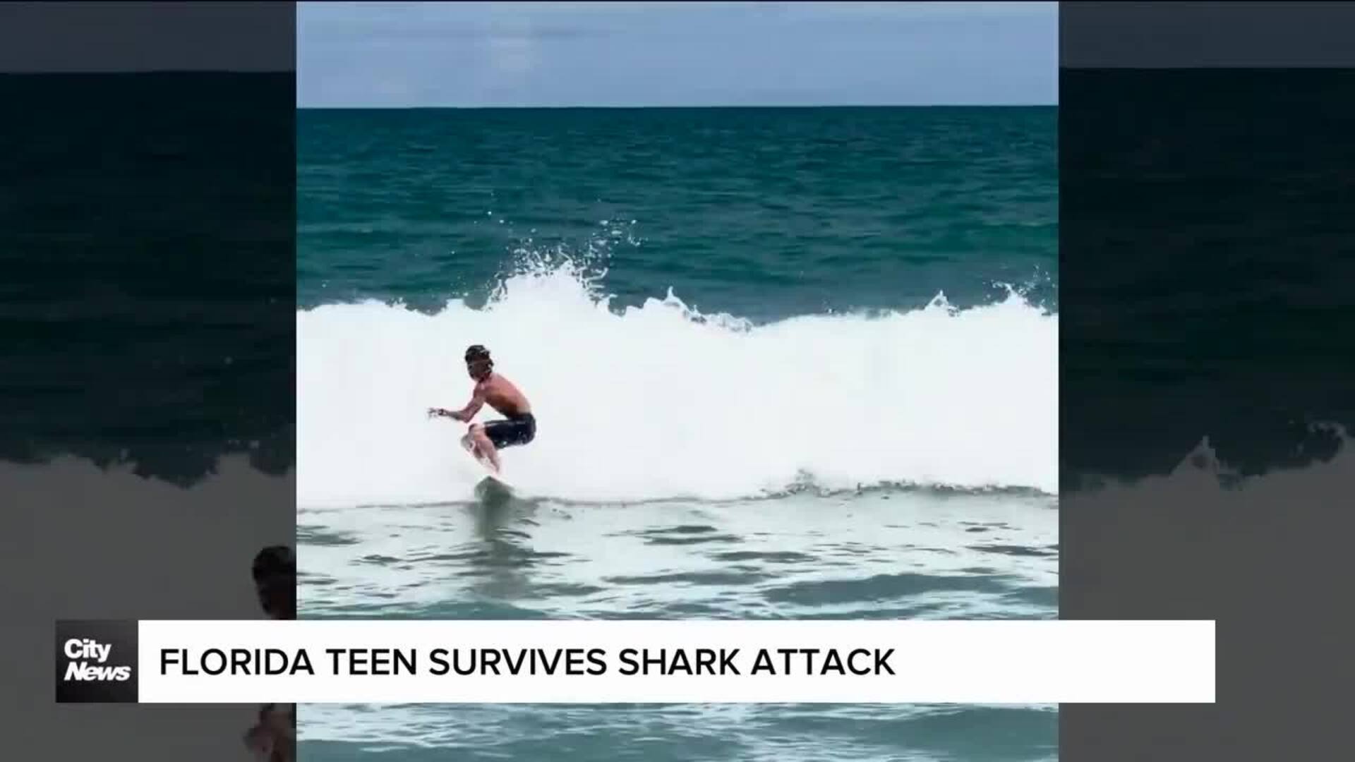 Teen survives shark bike