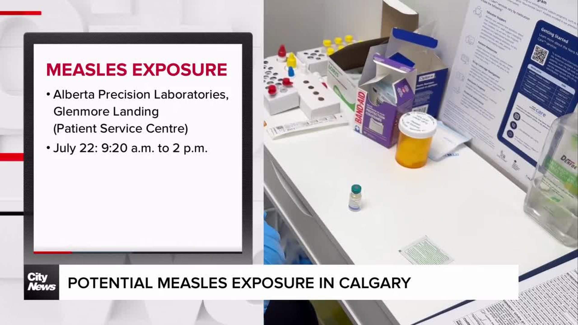 Potential measles exposure in Calgary