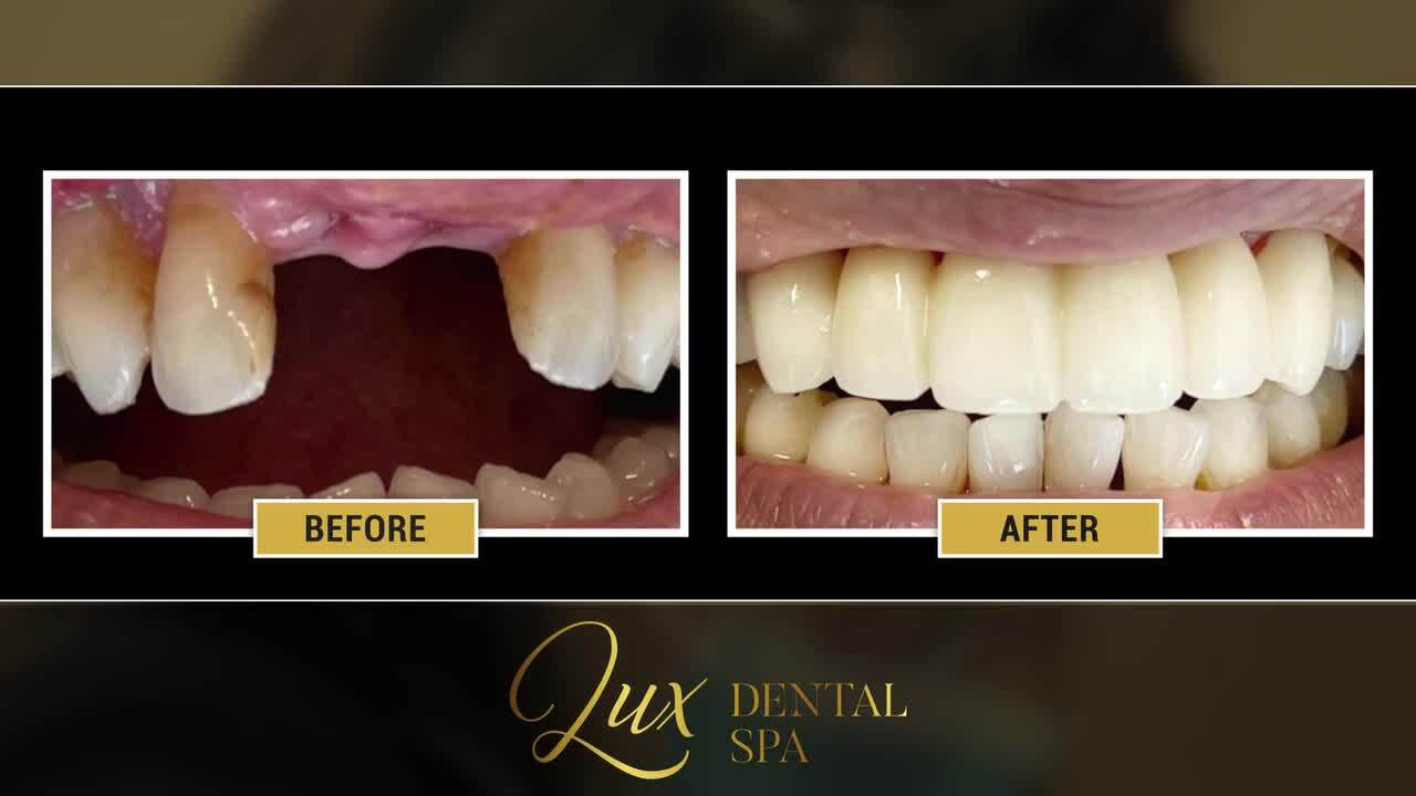 LALEH MEHRRAFIEE LUX DENTAL SPA Updated October 2024 52 Photos