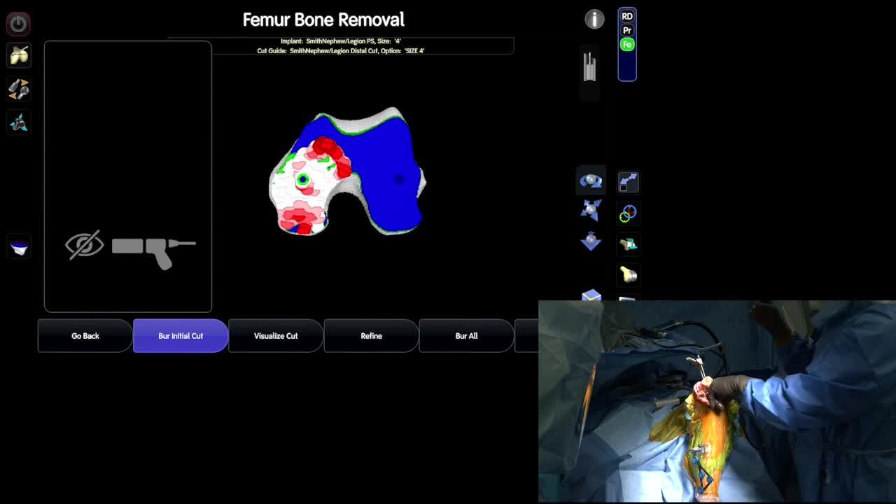 PS2 the 外科医. The cirugiao PS2 the 外科医. The cirugiao PS2 the 外科医. The cirugiao