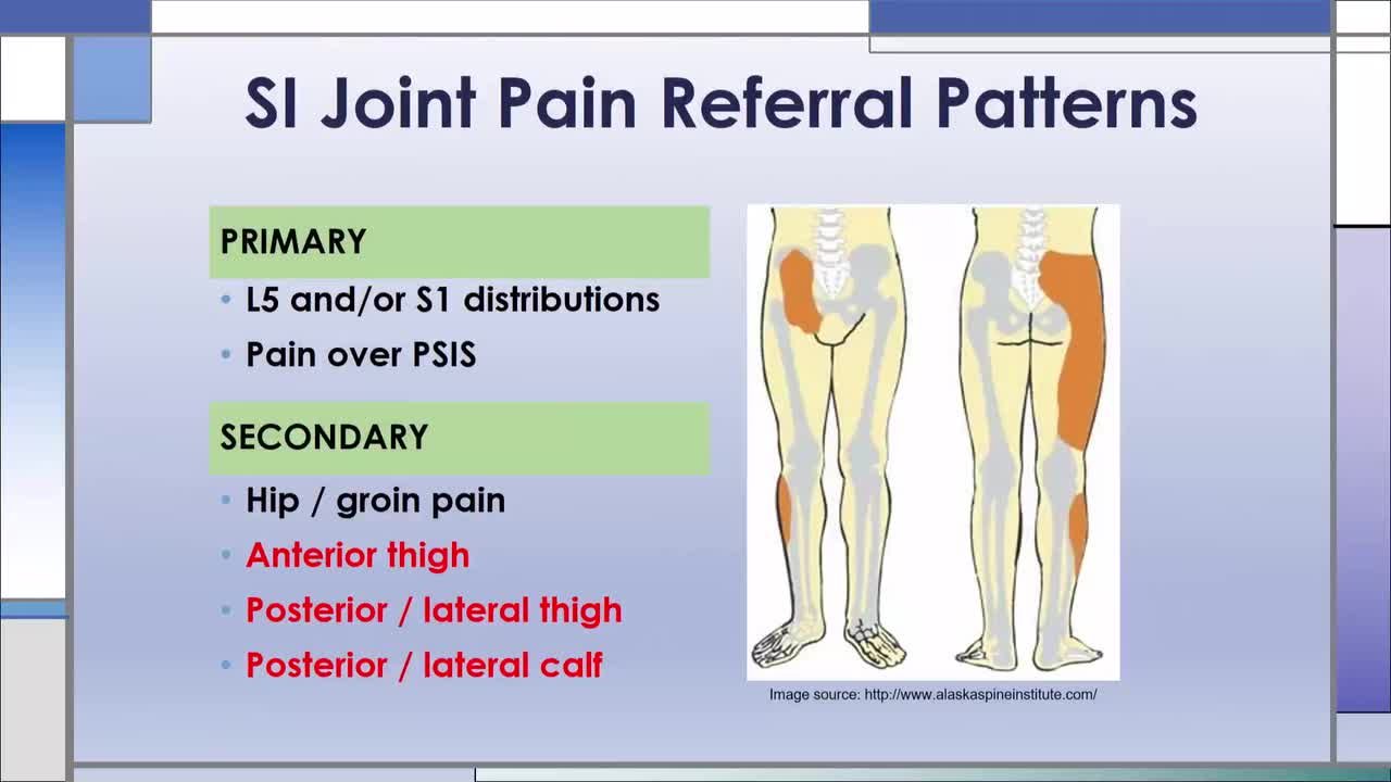 Si Joint Pain Referral Patterns Si Joint Pain Referral Patterns
