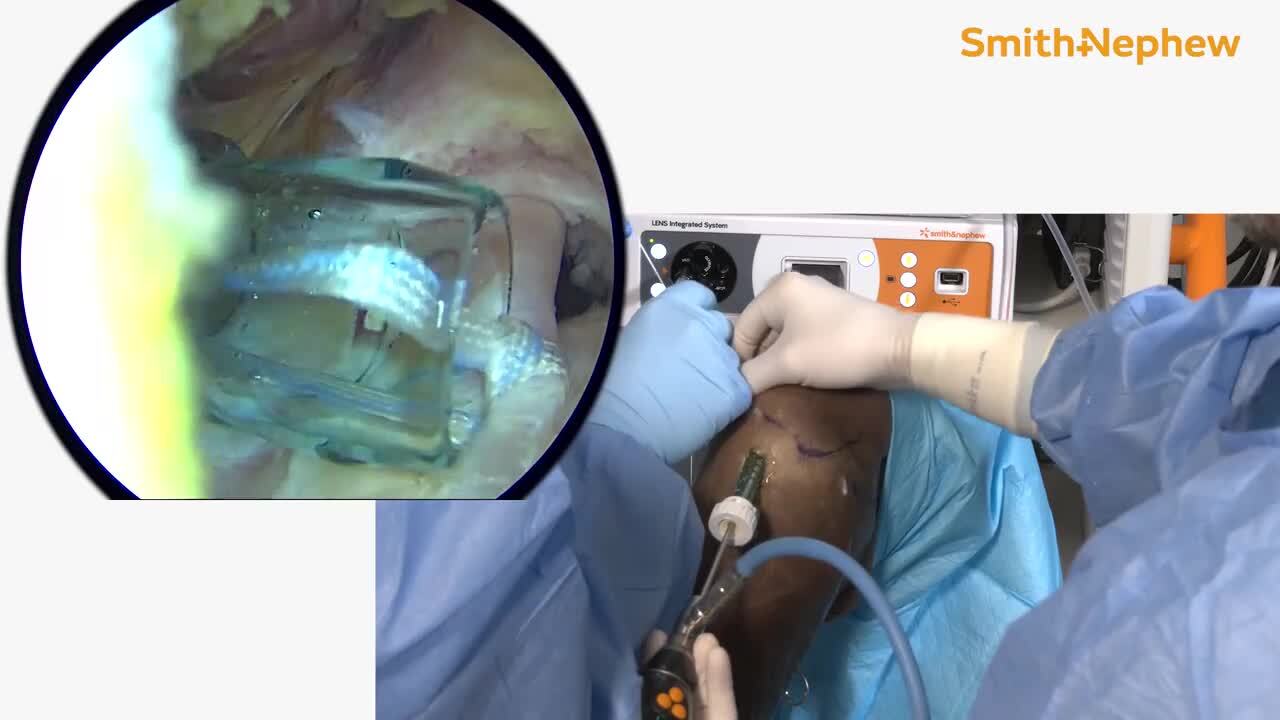 【SURGERY】surgery a bite of micro shorts Amazon.com: Post Surgery Tearaway Shorts with Side Snap