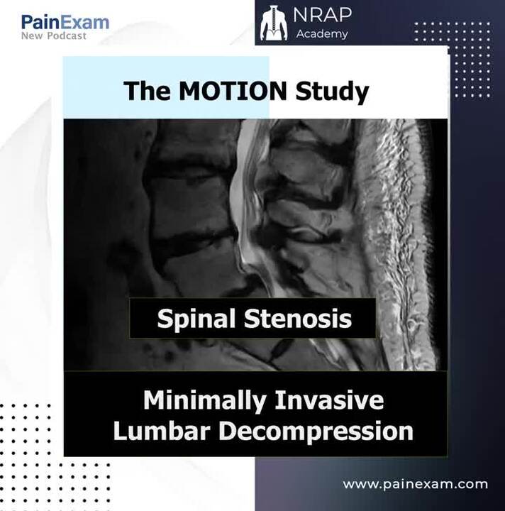 bpc-157 spinal stenosis Minimally Invasive Lumbar Decompression: The MOTION Study