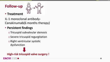Cryopyrin-associated periodic syndrome presenting with right ventricular endomyocardial fibrosis: a case report