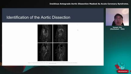 Presentation thumbnail