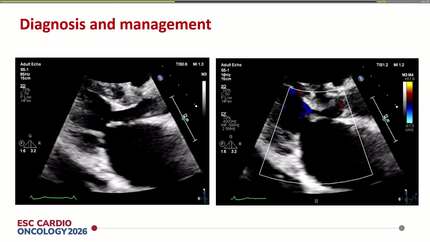 Presentation thumbnail