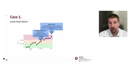 Artificial intelligence in intensive and acute cardiovascular care