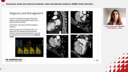 Presentation thumbnail
