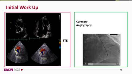 Presentation thumbnail
