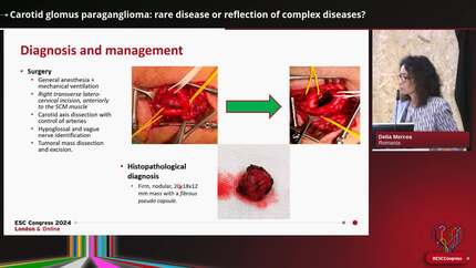 Presentation thumbnail