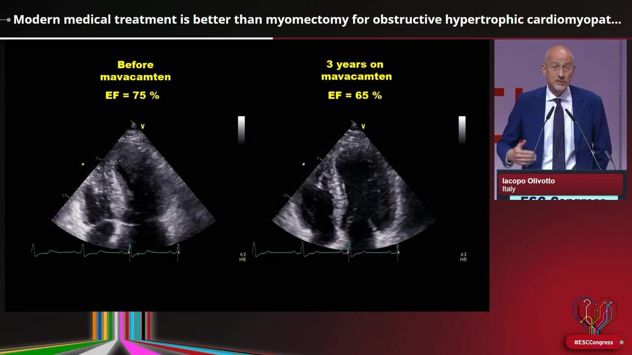 Modern medical treatment is better than myomectomy for obstructive hypertrophic cardiomyopathy: pro