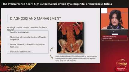 Unusual cases in pulmonary hypertension 