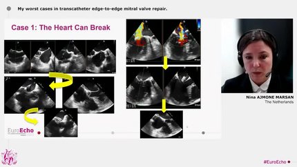 Presentation thumbnail