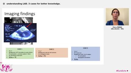 understanding LAD. 3 cases for better knowledge.
