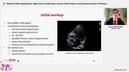 Patient with hypoplastic right heart syndrome, severe heart failure and unawareness of illness.