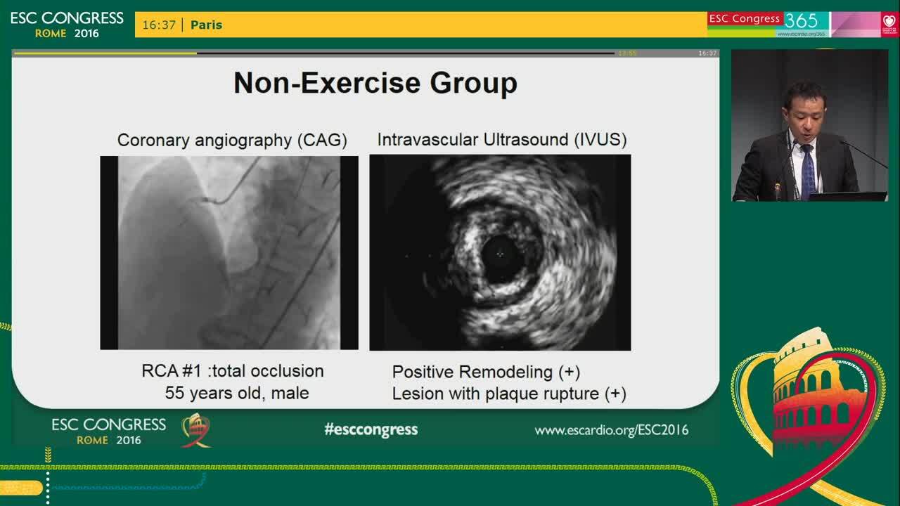 The atherosclerotic plaque disruption and coronary thrombosis is not responsible for exercise-related resuscitated out-of-hospital cardiac arrest due to ischemia
