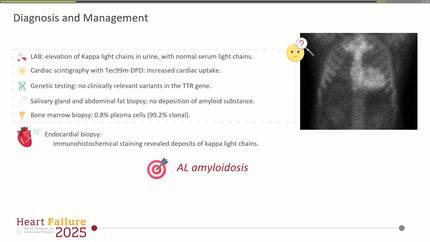 A case of AL amyloidosis - a Lost race against time