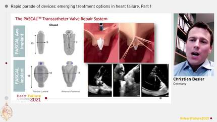 Presentation thumbnail