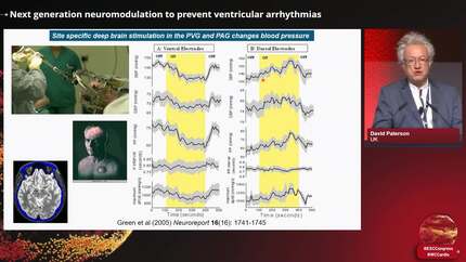 Next generation neuromodulation to prevent ventricular arrhythmias