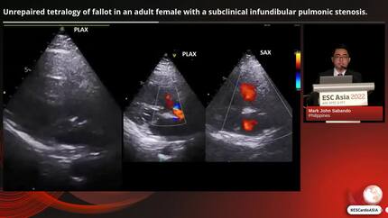 Presentation thumbnail