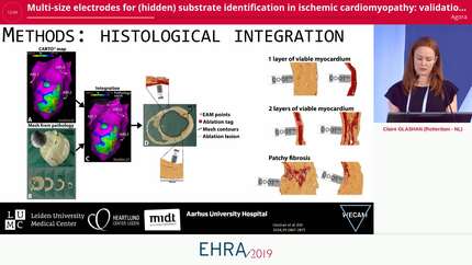 Multi-size electrodes for (hidden) substrate identification in ischemic cardiomyopathy: validation by integration of whole heart histology