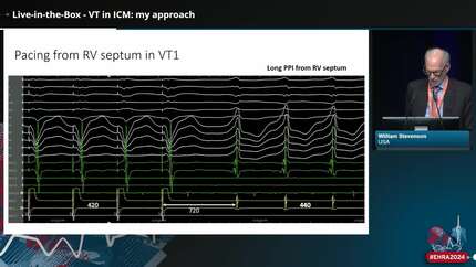 Live case session - VT ablation in ischaemic CMP: how to improve the outcomes