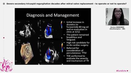 Severe secondary tricuspid regurgitation decades after mitral valve replacement - to operate or not to operate?