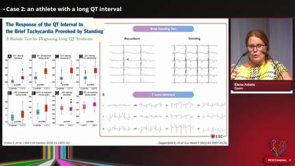 Clinical Case Management: athletes with rhythm problems - what to consider when recommending exercise