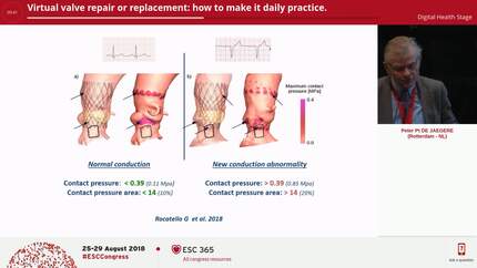 Virtual valve repair or replacement: how to make it daily practice.