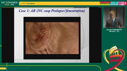 Presentation thumbnail
