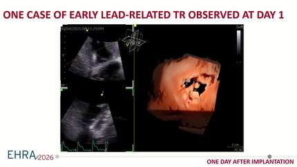 Presentation thumbnail