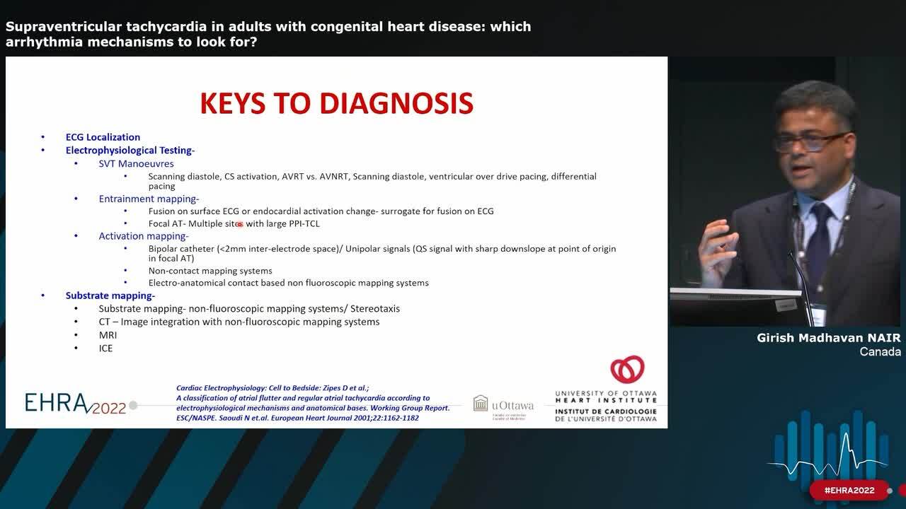 Supraventricular tachycardia in adults with congenital heart disease: which arrhythmia mechanisms to look for?