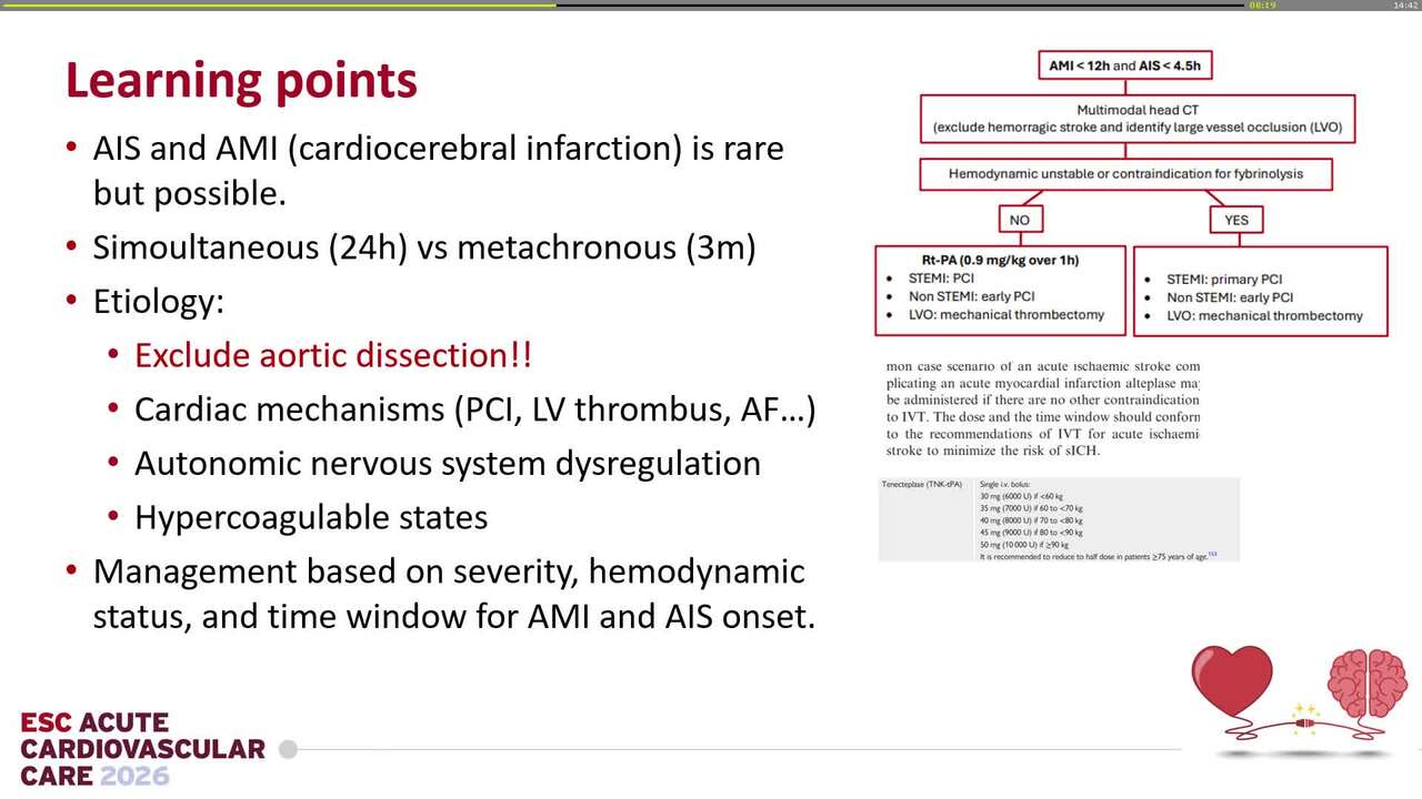 Ischemic stroke as first manifestation of acute myocardial infarction complicated by ventricular septal rupture.