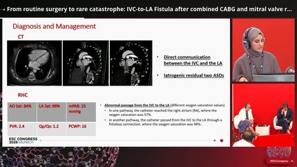 From routine surgery to rare catastrophe: IVC-to-LA Fistula after combined CABG and mitral valve replacement