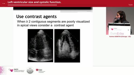 Presentation thumbnail