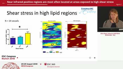 Near infrared positive regions are most often located at areas exposed to high shear stress